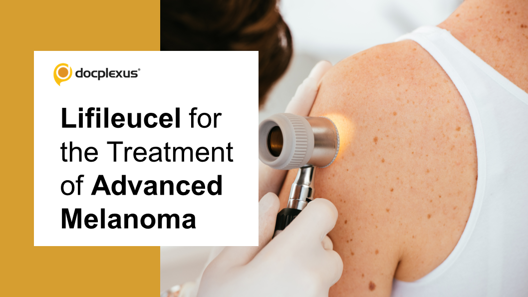 USFDA Approves Lifileucel for the Treatment of Advanced Melanoma