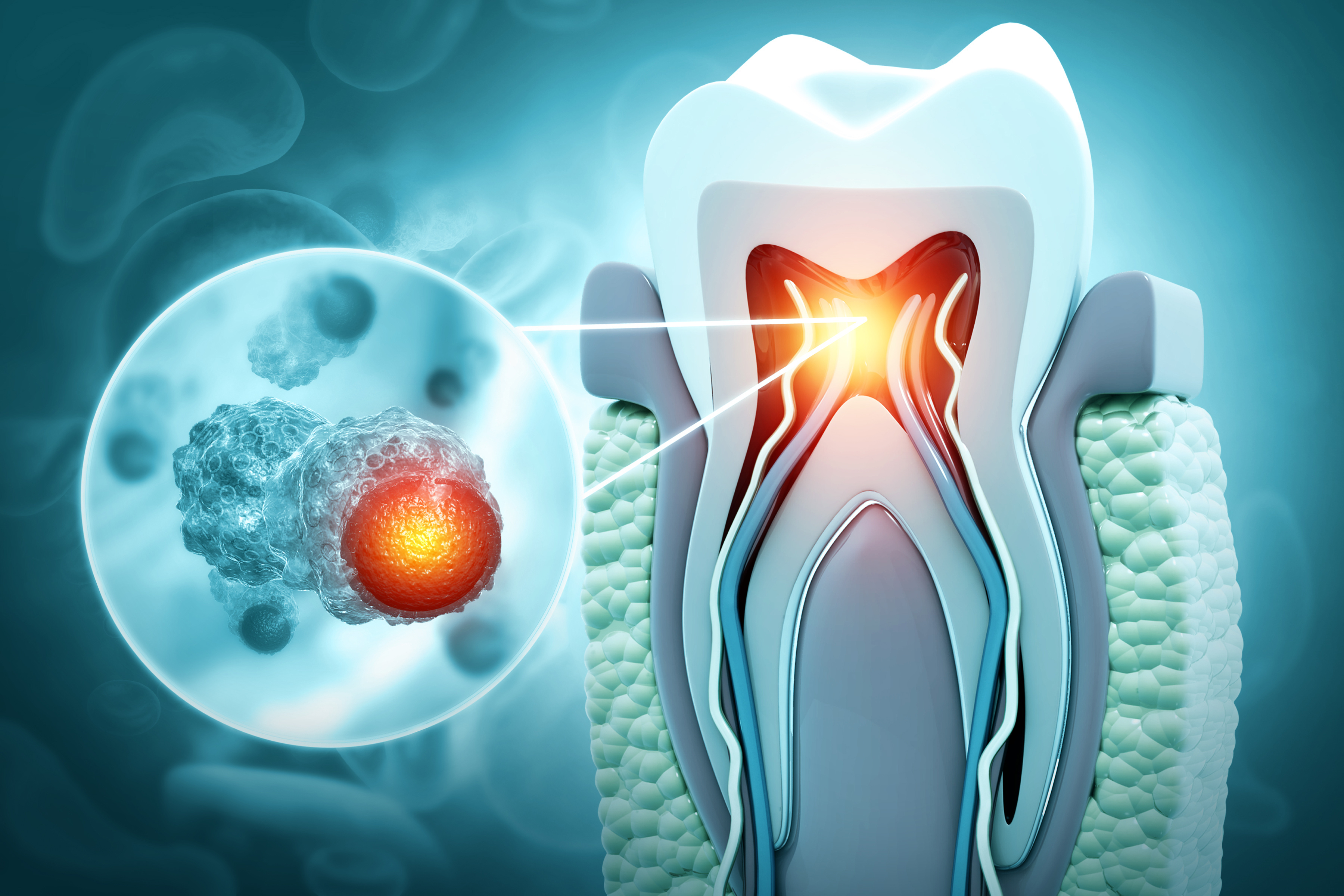 Antimicrobial Effect of Platelet‑rich Plasma and Platelet‑rich Fibrin