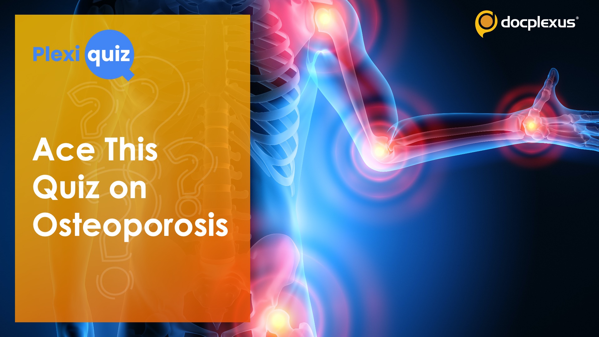 Quiz Time! Test Your Knowledge of Osteoporosis