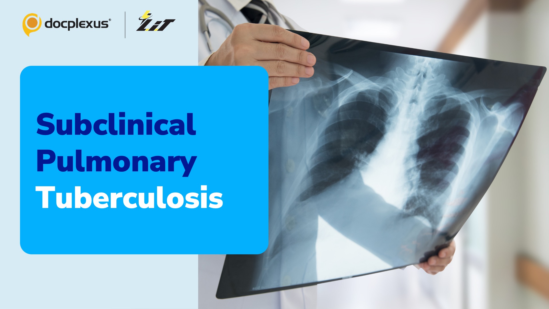 Alarming Levels of Subclinical Pulmonary TB in Africa and Asia