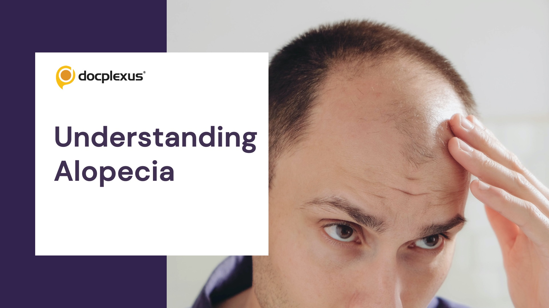 Understanding Alopecia: Causes, Symptoms, and Treatment