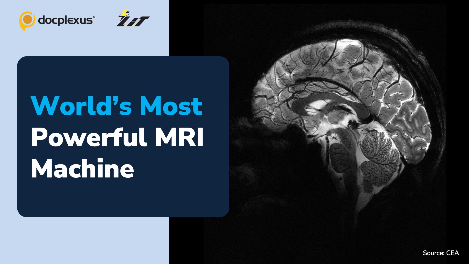 World’s Most Powerful MRI Scanner Produces Brain Images of Unprecedented Quality
