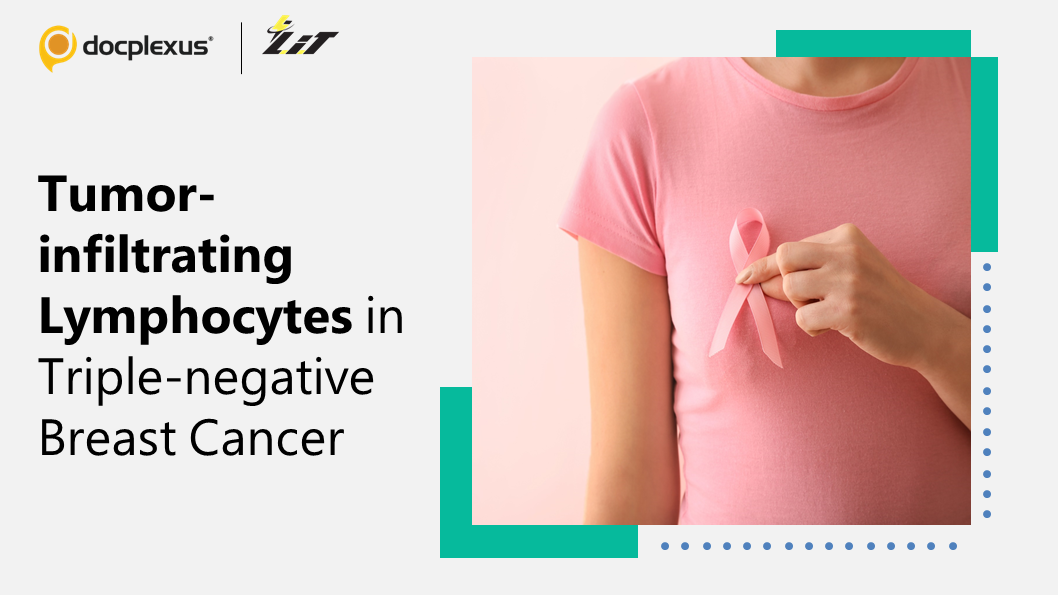 Elevated Levels of Immune Cells Linked to Lower Relapse in Triple-negative Breast Cancer