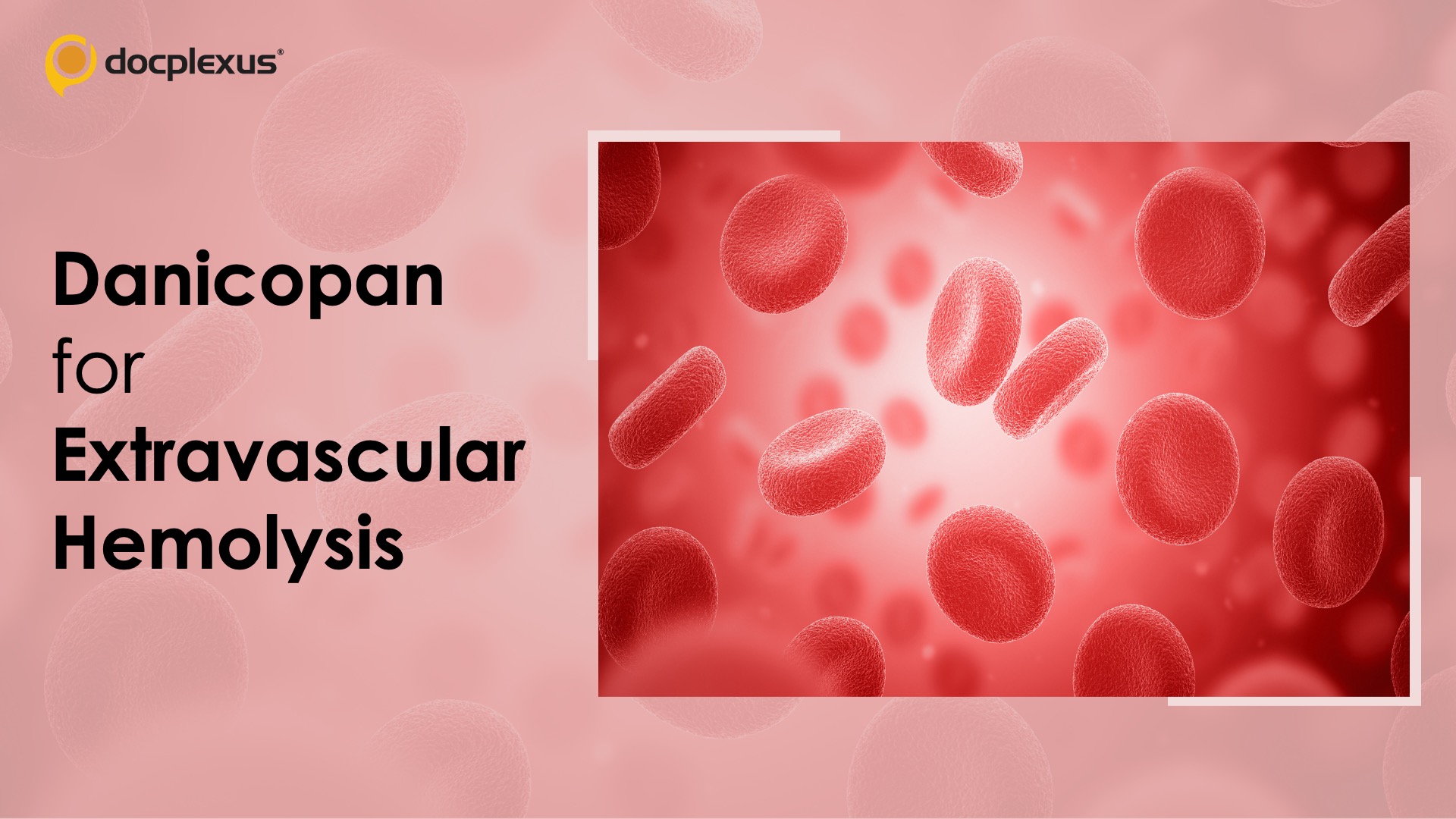 USFDA Approves Danicopan Add-on Therapy for Hemolysis in PNH Patients