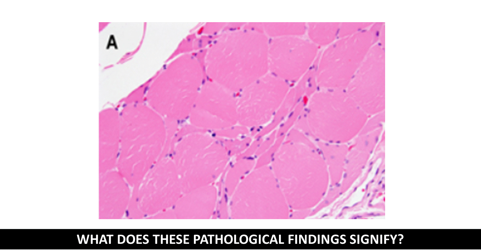 Can You Diagnose This  Patient's  Condition?