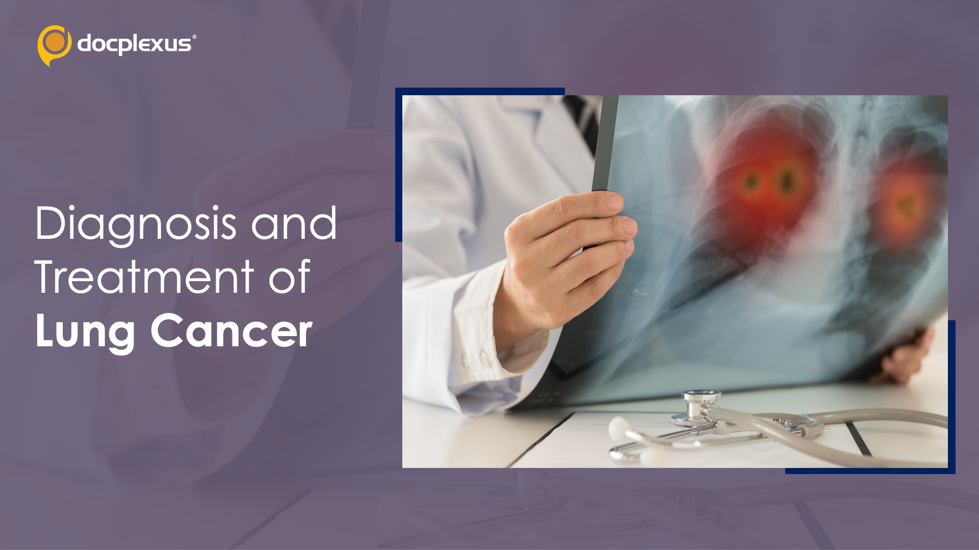Lung Cancer: Advances in Disease Management