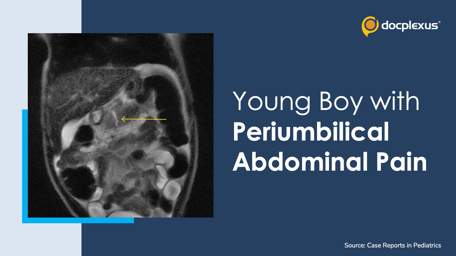Case of a Young Boy with Periumbilical Abdominal Pain