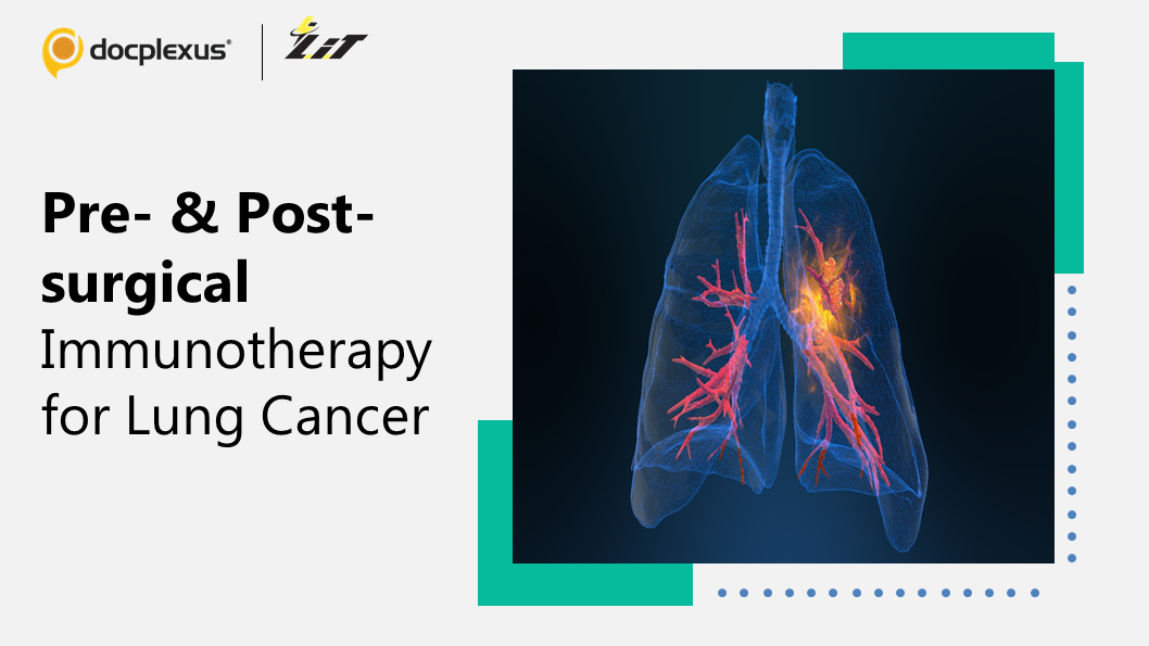 Pre- & Post-surgical Immunotherapy Improves Outcomes in Operable Lung Cancer