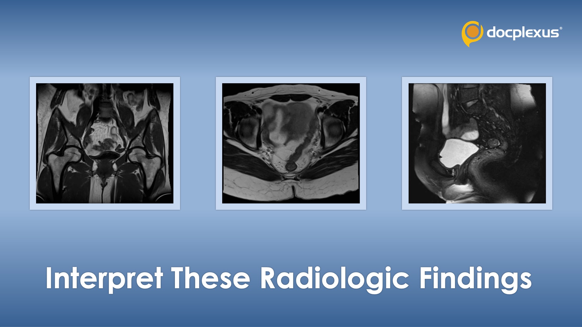 Interpret These Radiologic Findings