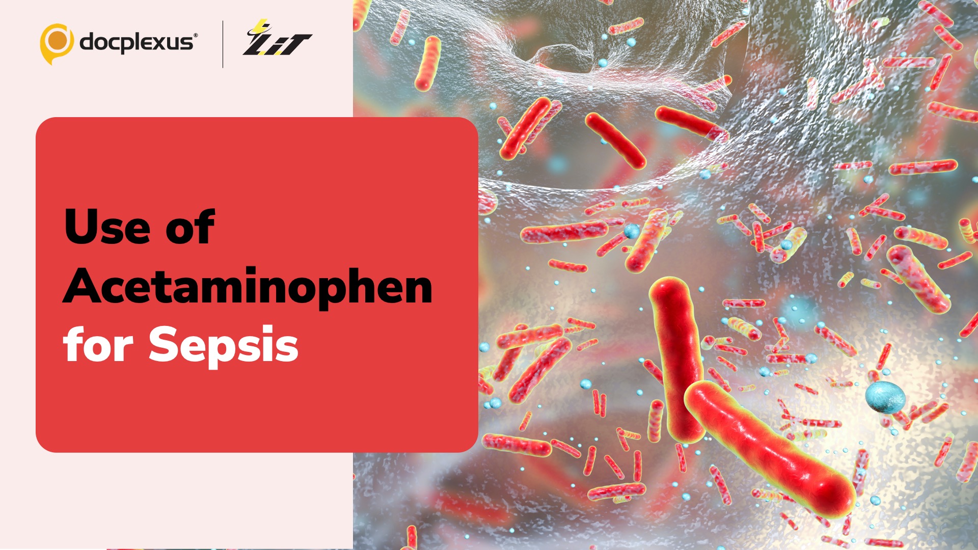 Can Acetaminophen Prevent ARDS in Sepsis Patients?