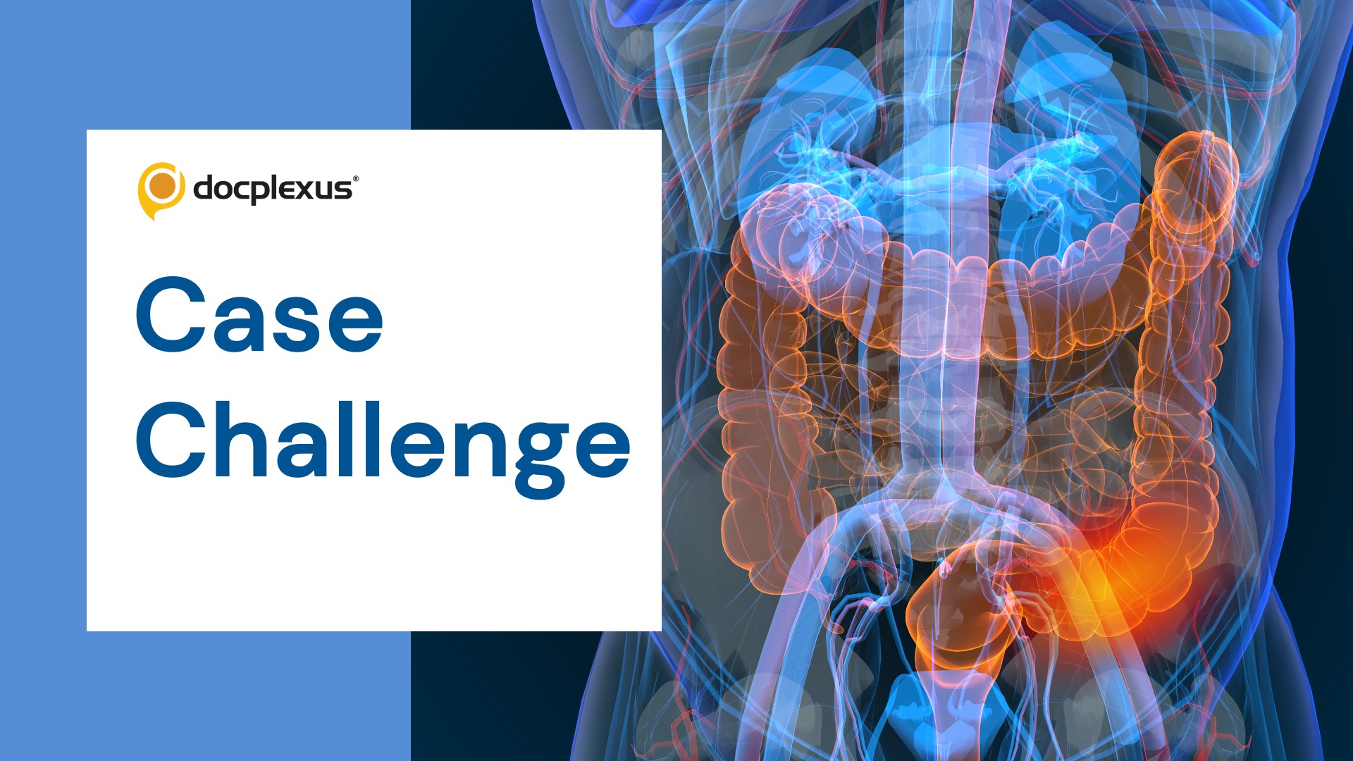 A Case of Metastatic Colorectal Cancer