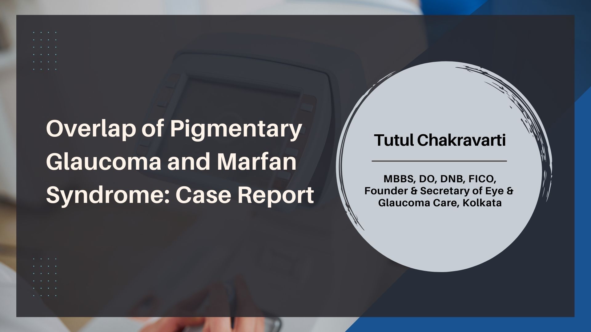 Overlap of Pigmentary Glaucoma and Marfan Syndrome: Case Report