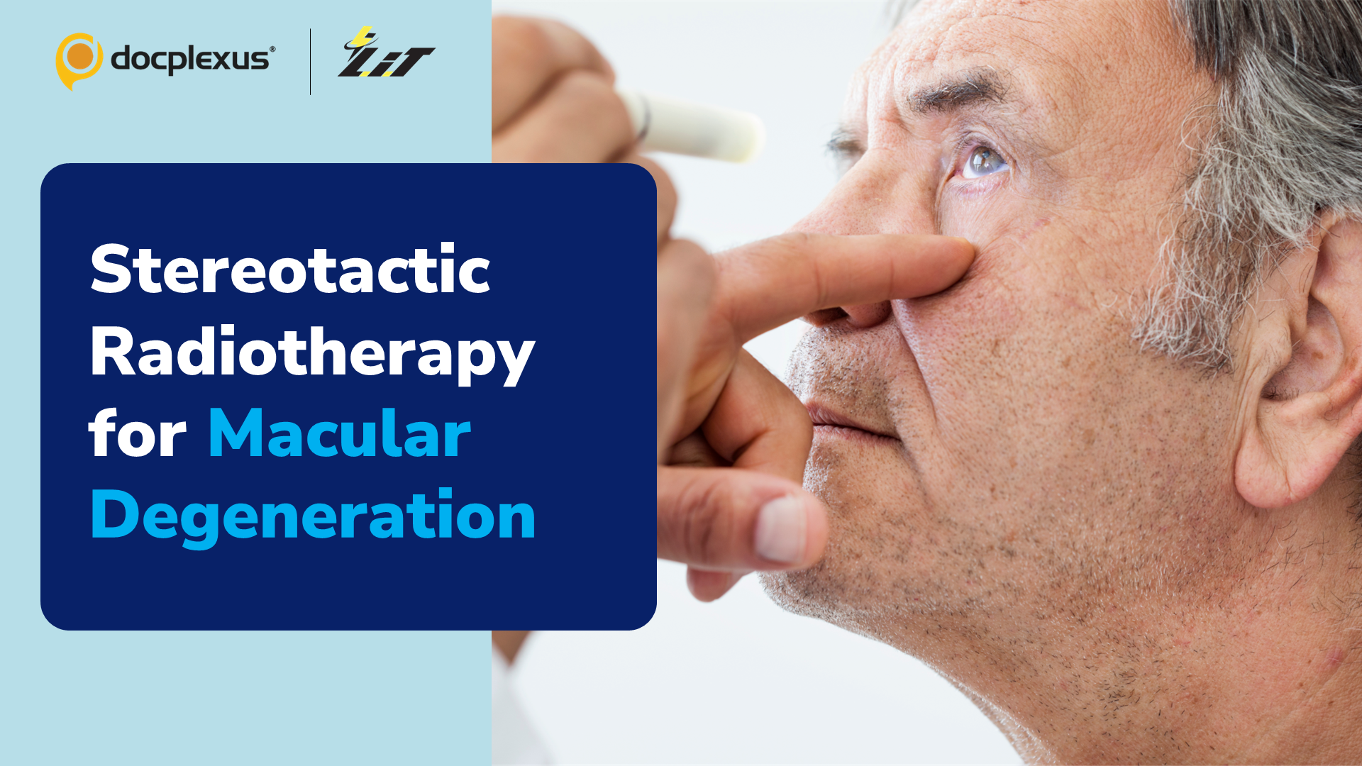 Robot Radiotherapy for Neovascular Age-related Macular Degeneration