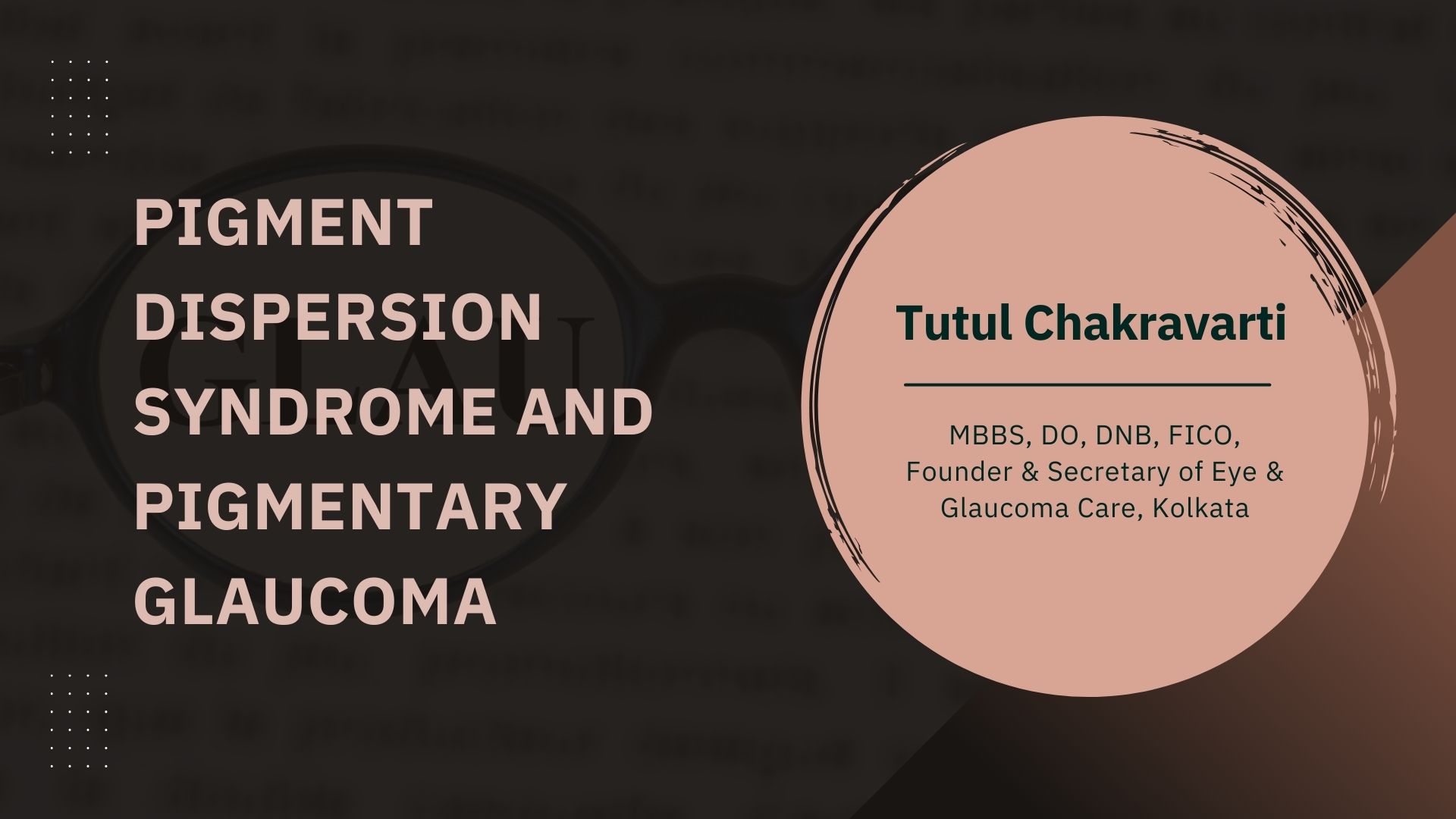 Pigment Dispersion Syndrome and Pigmentary Glaucoma