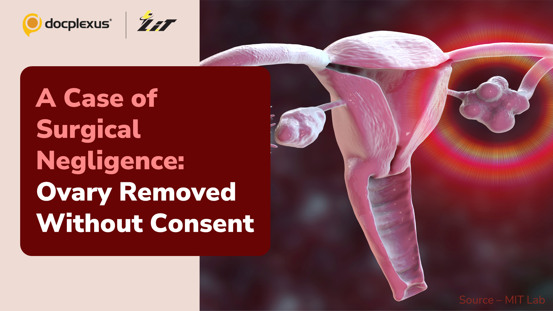 Medical Error: Ovary Removed Without Consent, Mop Pad Left Inside the Abdomen