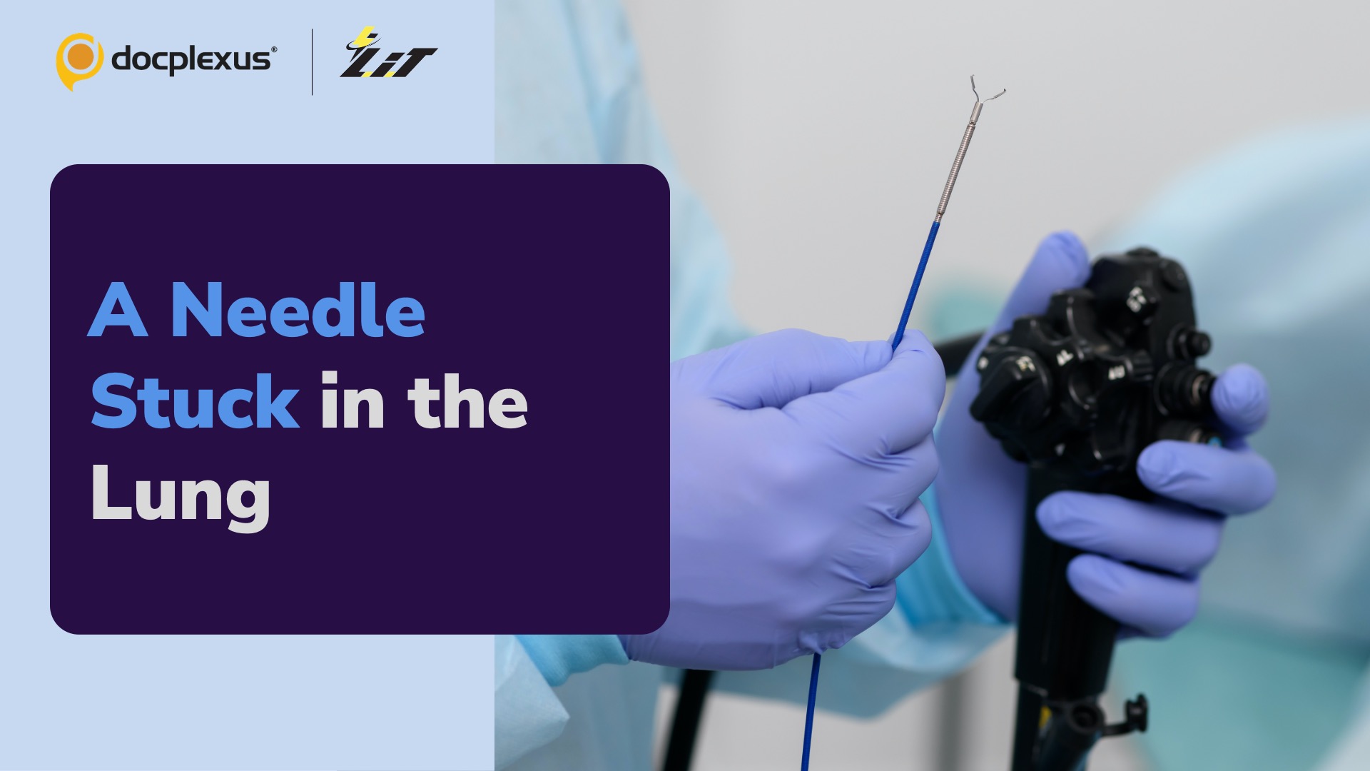 Doctors Remove a Needle from the Lung Within a Few Minutes