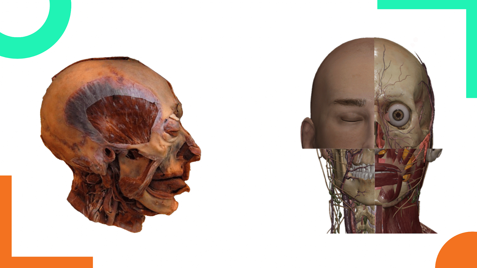 From Cadavers to Pixels: The Evolution of Anatomy Education