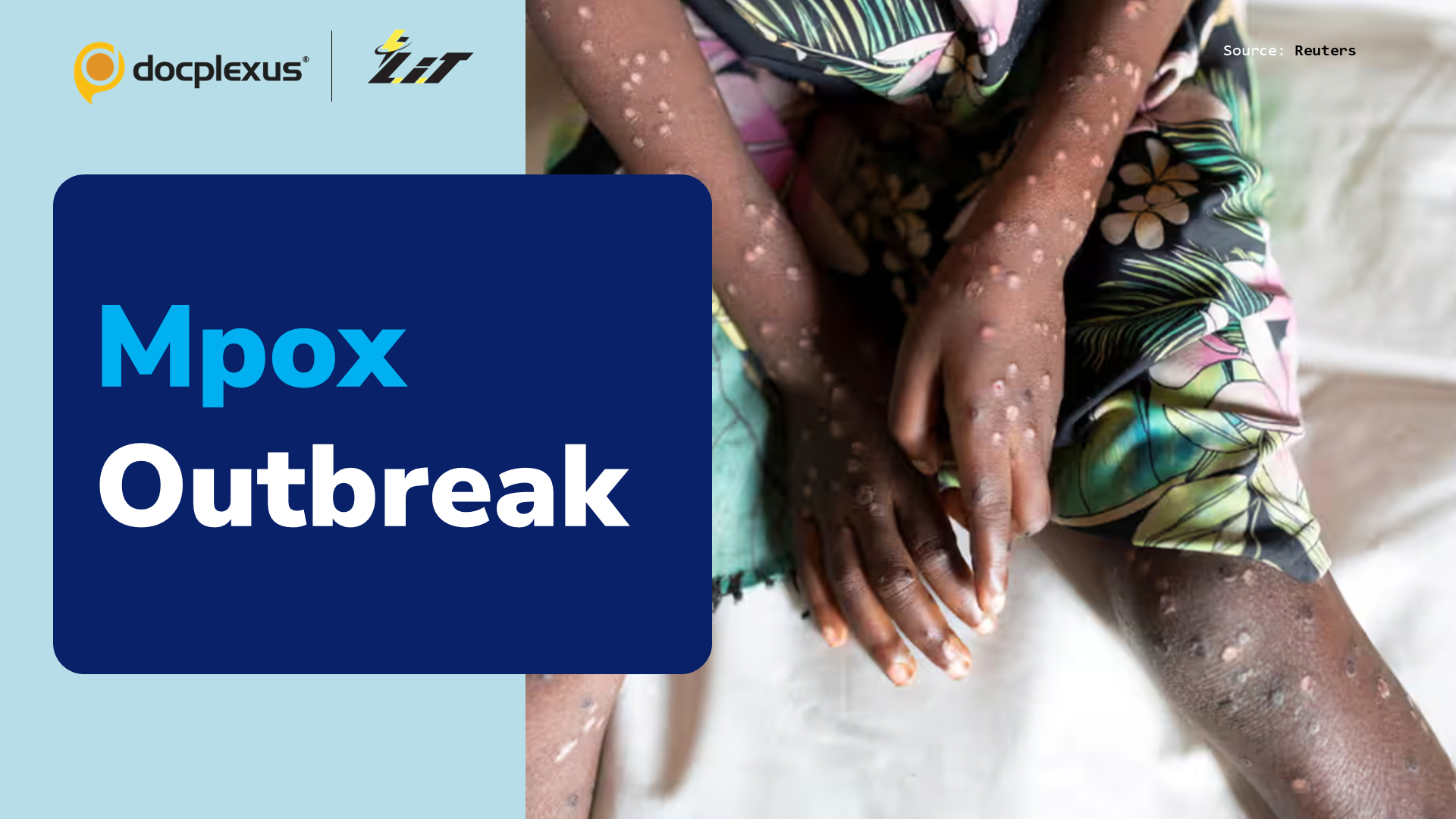 Central African Republic Declares Mpox Outbreak