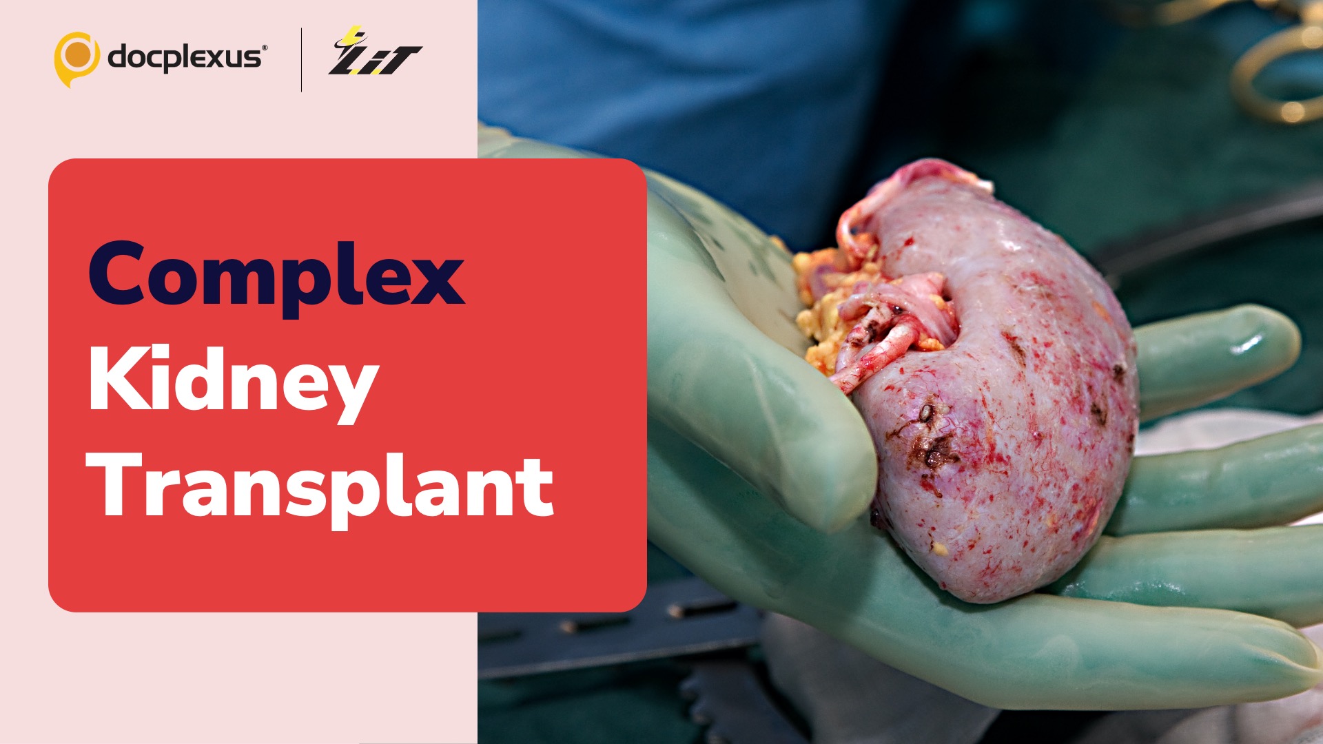 Pune Surgeons Perform a Complex Kidney Transplant