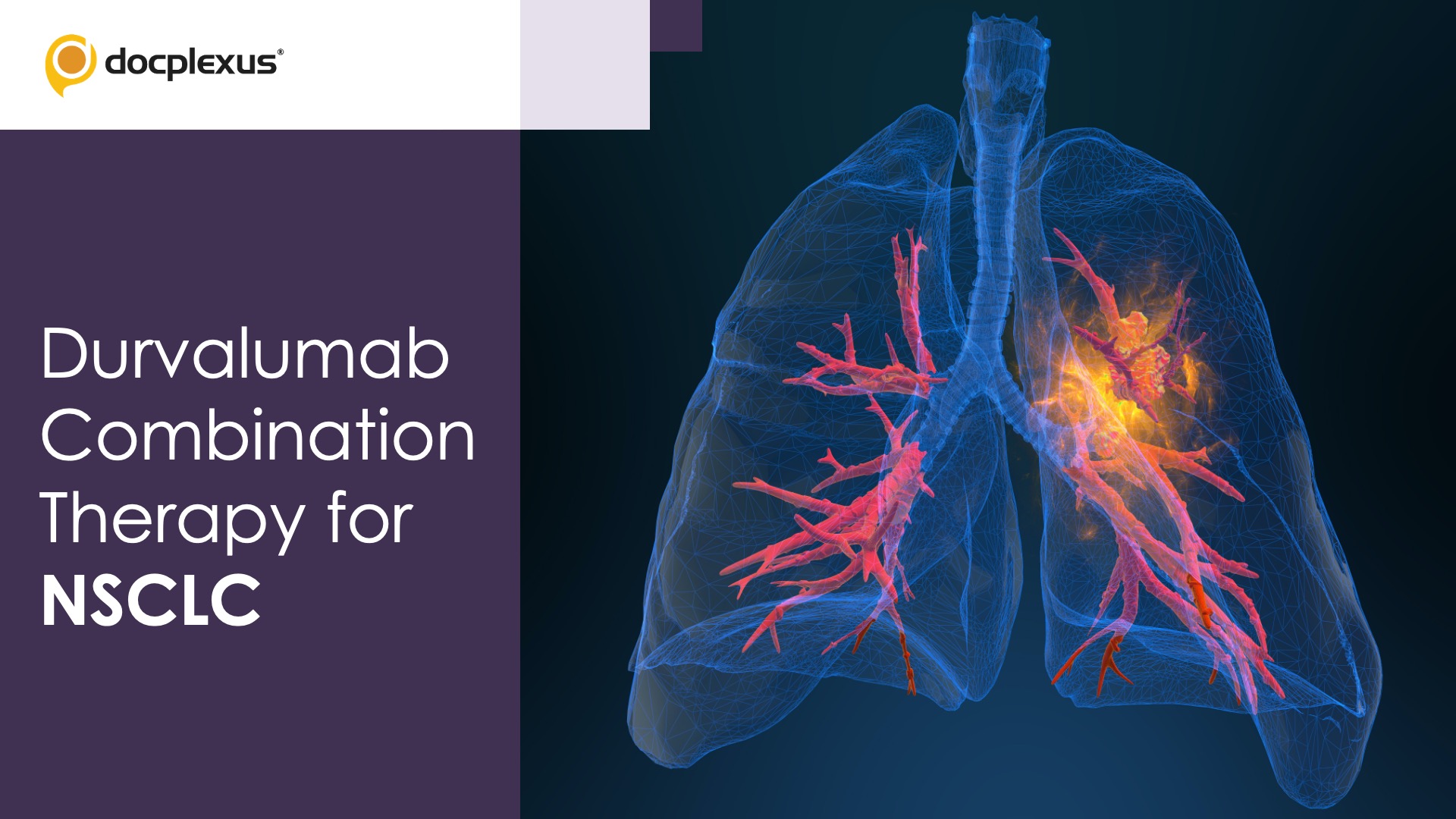 USFDA Approves Durvalumab Combination Therapy for Adults with NSCLC
