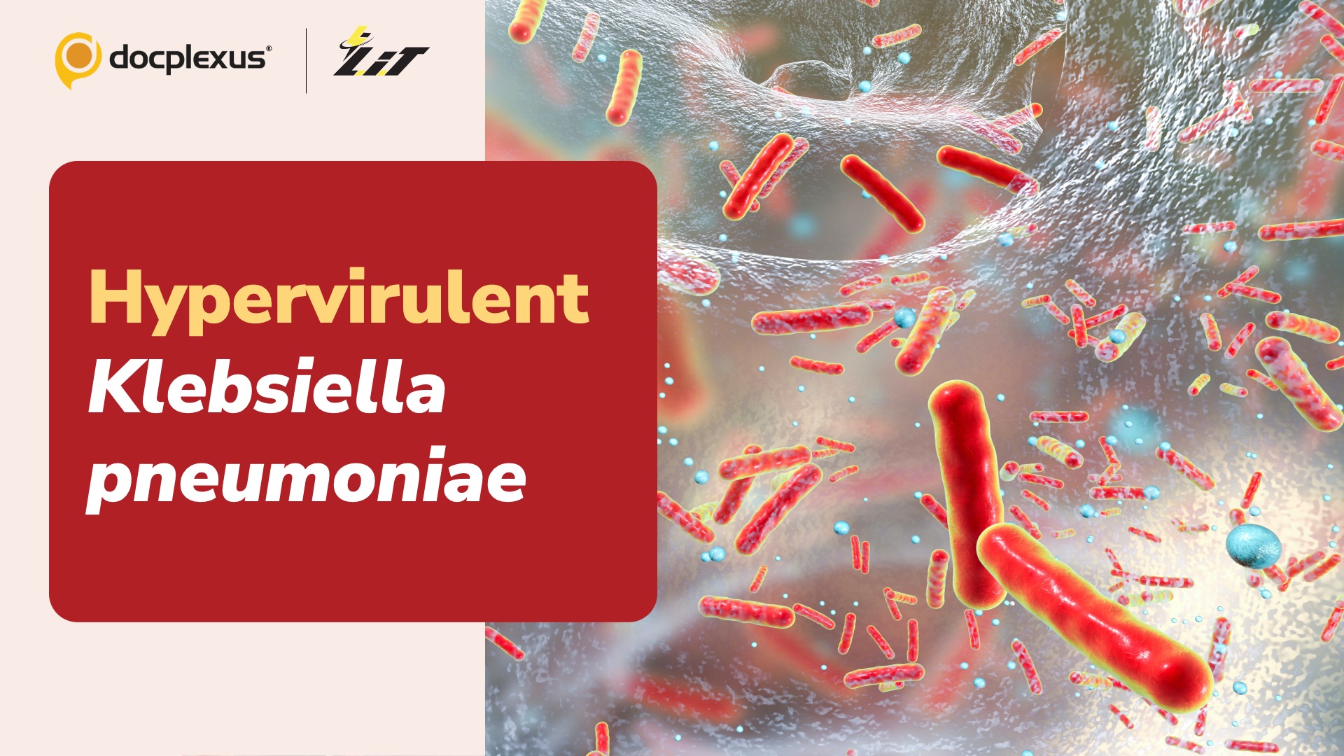 WHO Issues Latest Alert on Hypervirulent Klebsiella pneumoniae