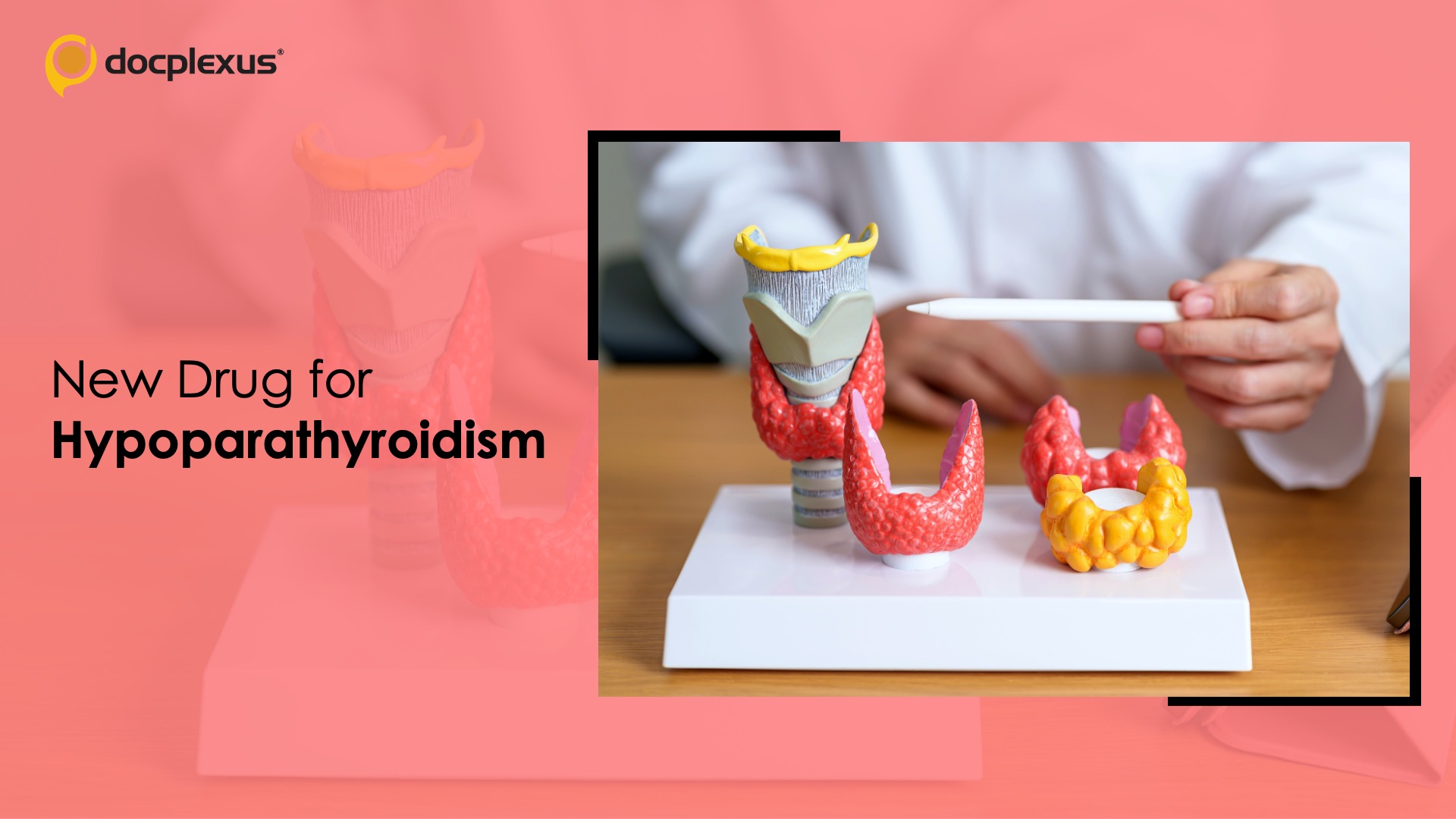 USFDA Approves Palopegteriparatide for Hypoparathyroidism
