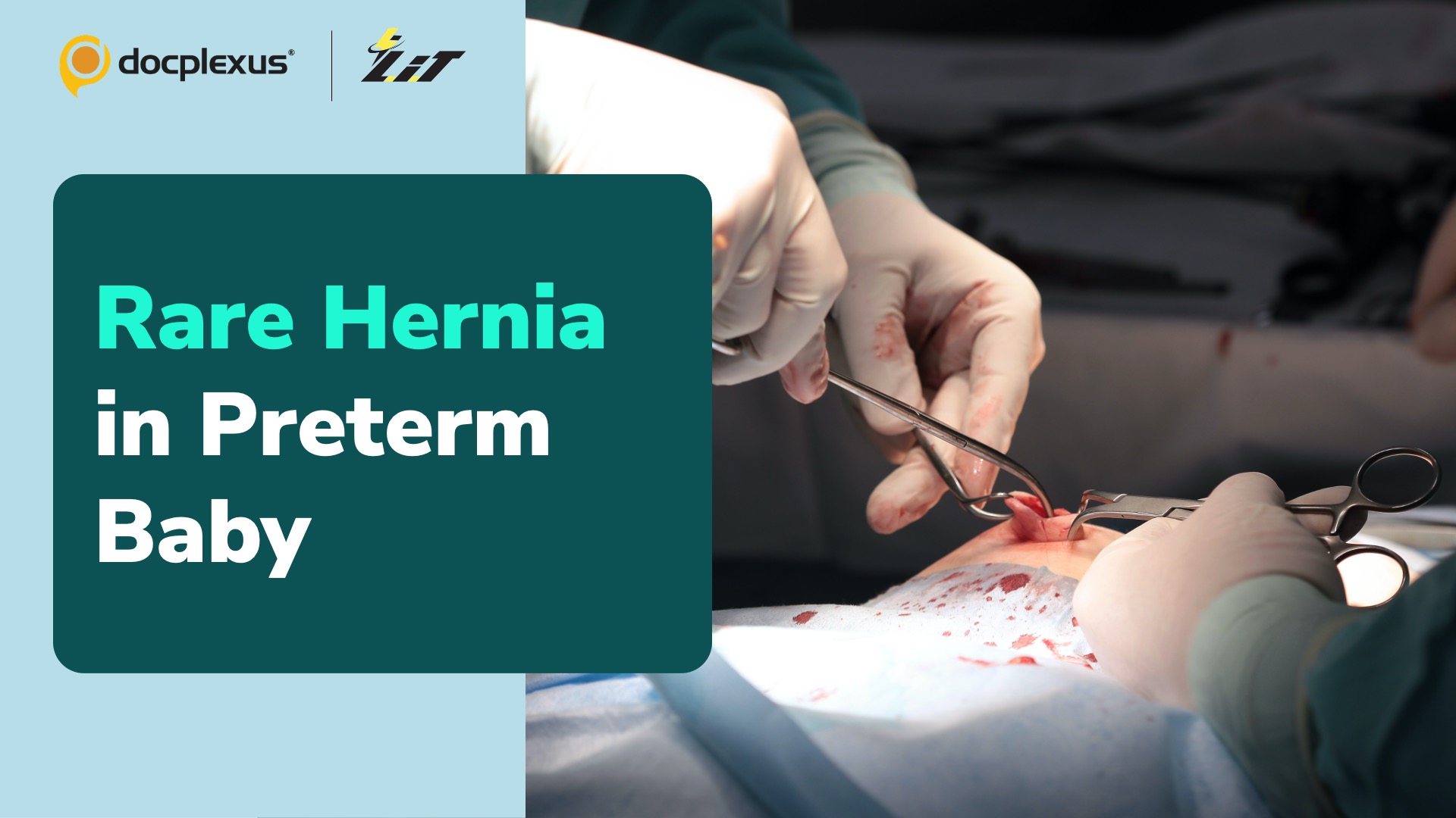 Chennai Surgeons Repair Rare Hernia in Premature Baby