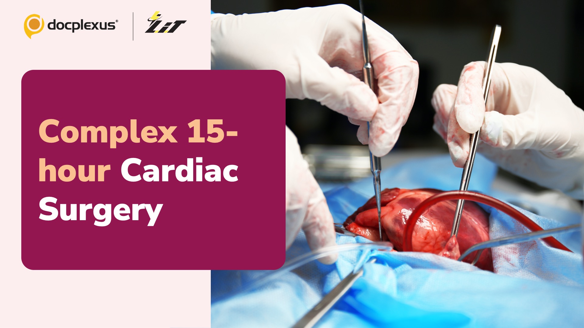 Doctors Perform a Complex 15-hour Cardiac Surgery