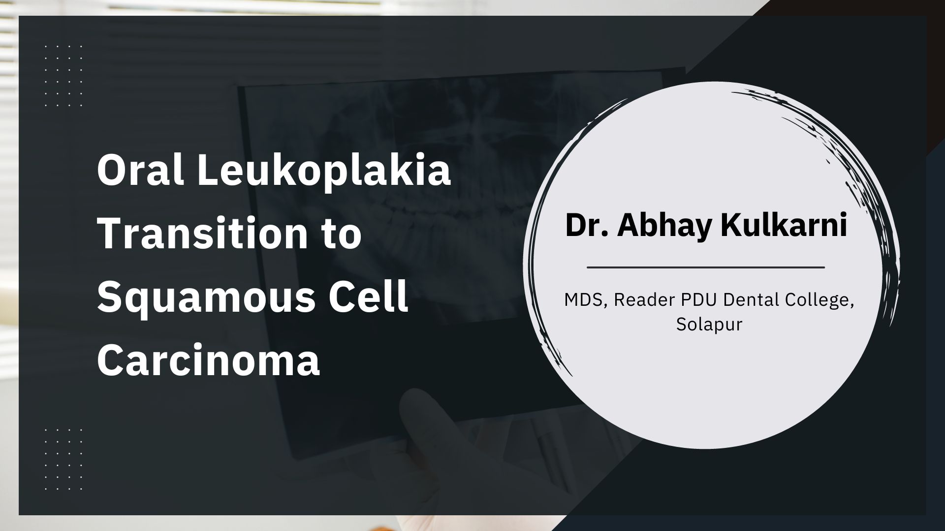 Transition of Oral Leukoplakia into Squamous Cell  Carcinoma