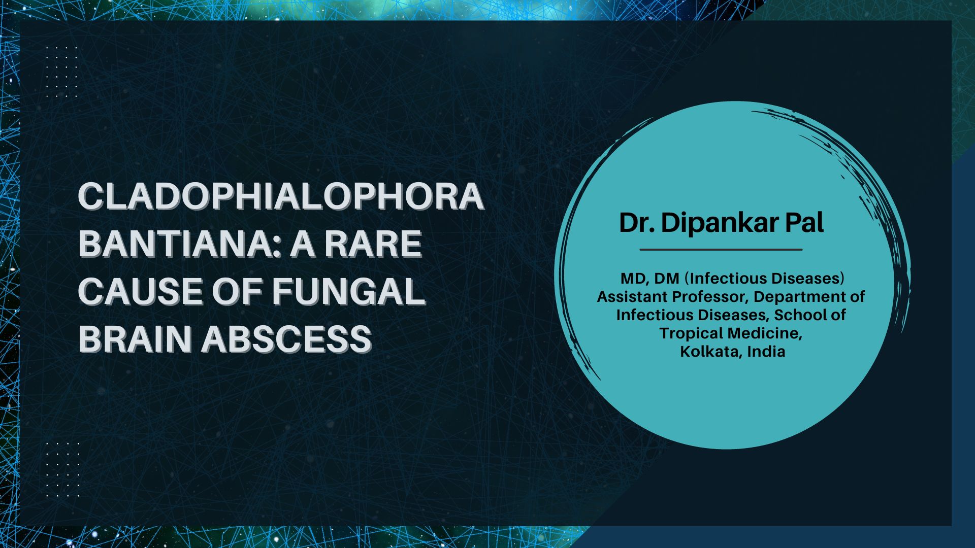 Cladophialophora bantiana: A Rare Cause of Soil-Transmitted Fungal Brain Abscess in the Tropics