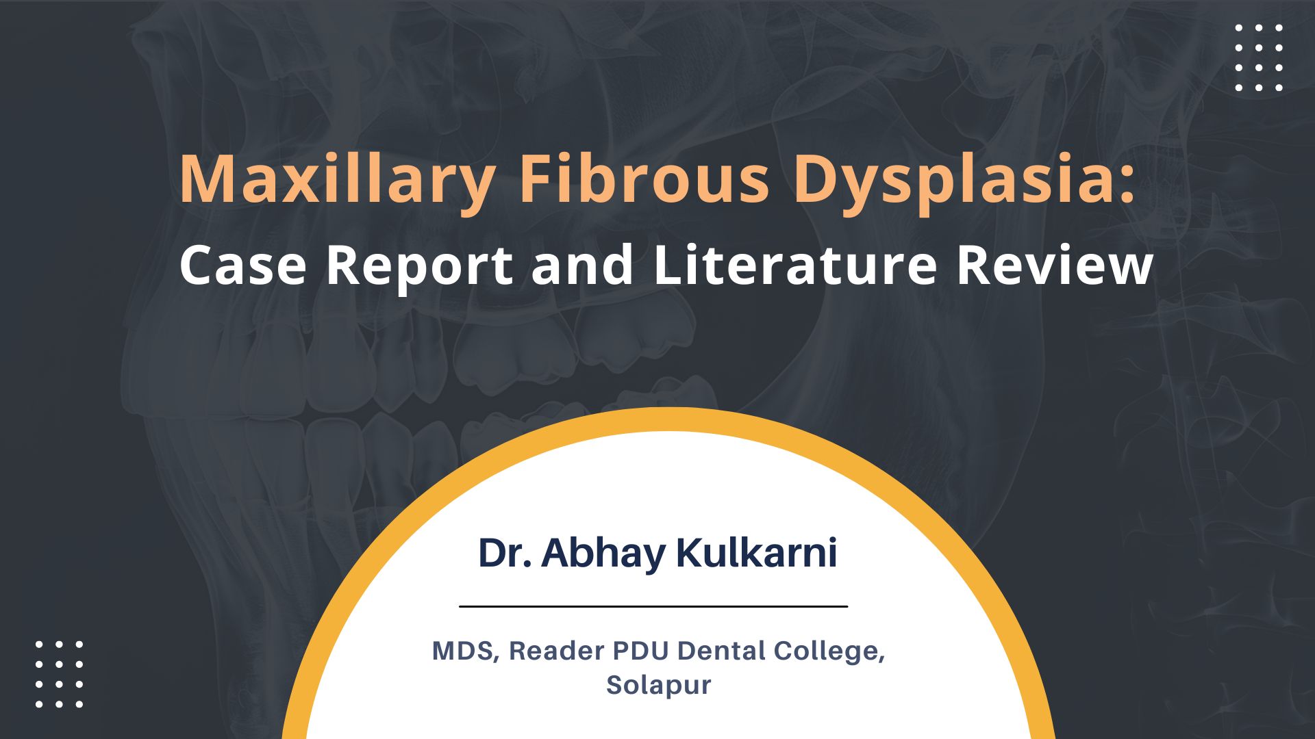Maxillary Fibrous Dysplasia: Case Report and Literature Review