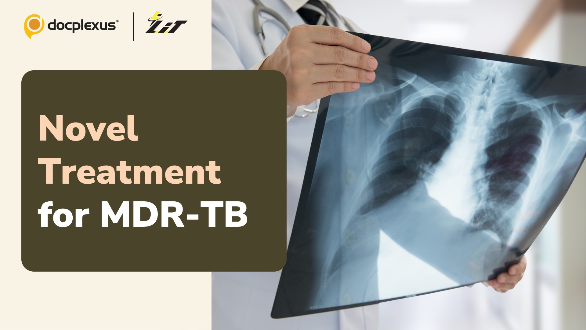 Health Ministry Introduces New Treatment Regimen for MDR-TB