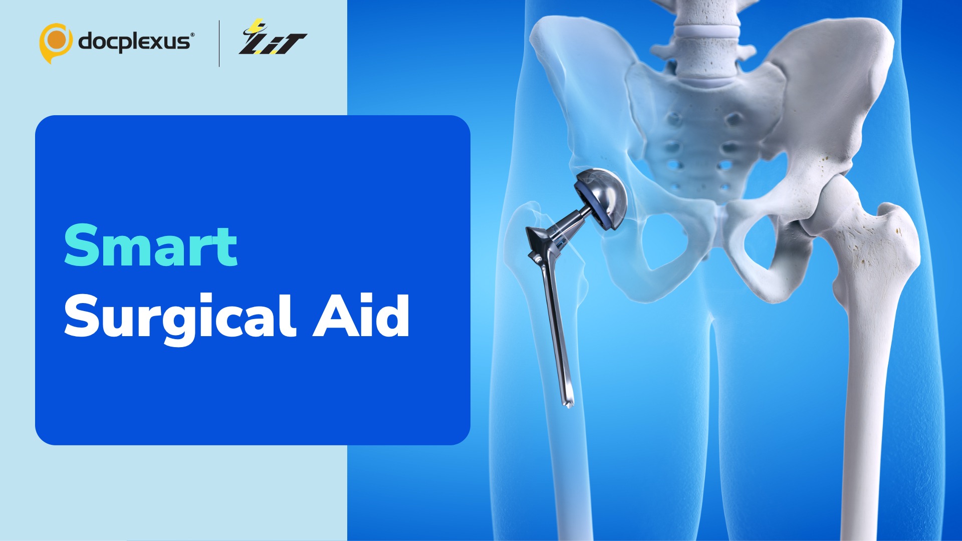 Researchers Develop Smart Surgical Aid for Hip Replacement Surgery