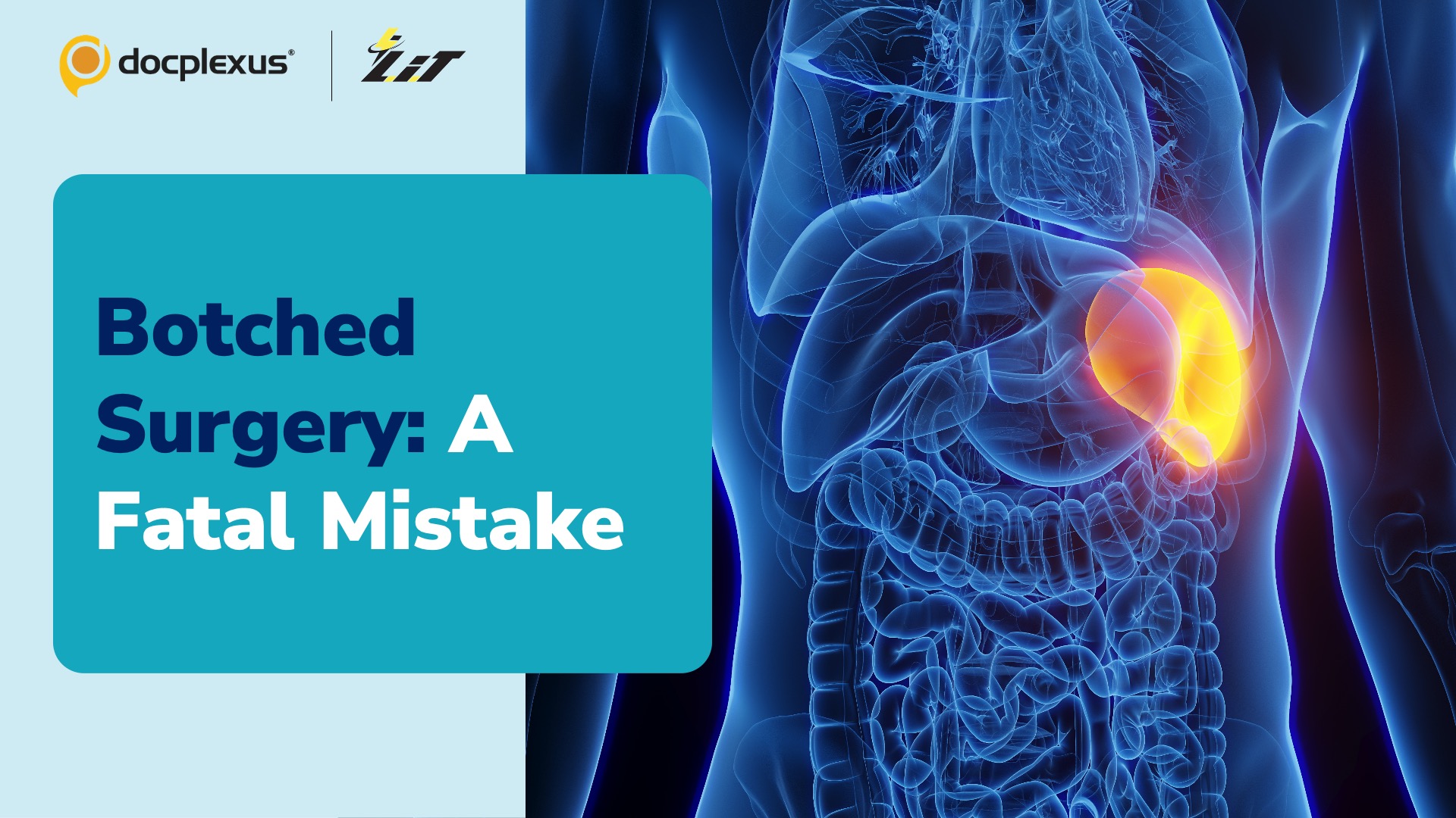 Florida Surgeon Removes Patient’s Liver Instead of Spleen