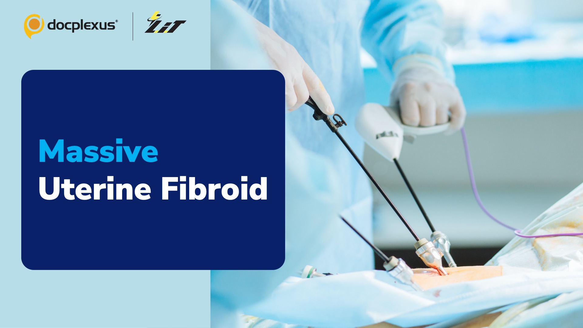 UAE Surgeons Remove Fetus-sized Fibroid from Patient