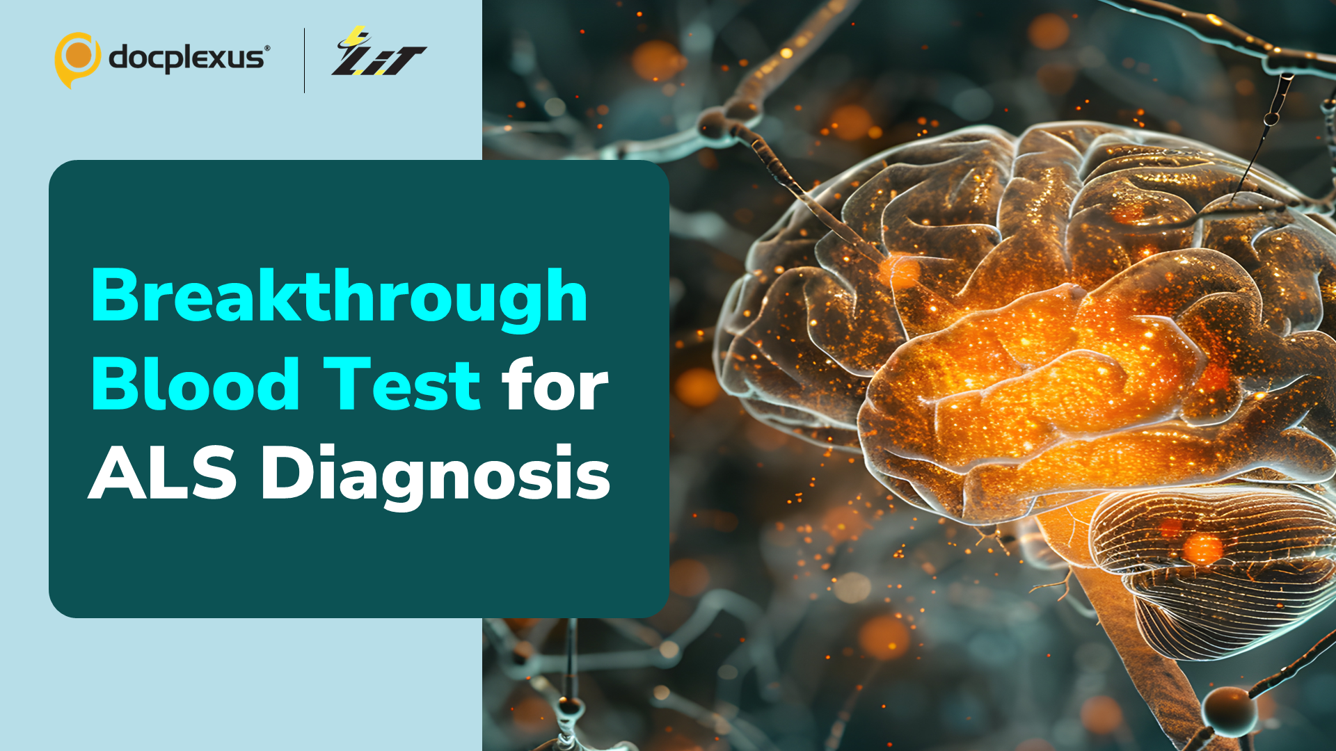 Advanced Blood Test Detects Amyotrophic Lateral Sclerosis with High Precision