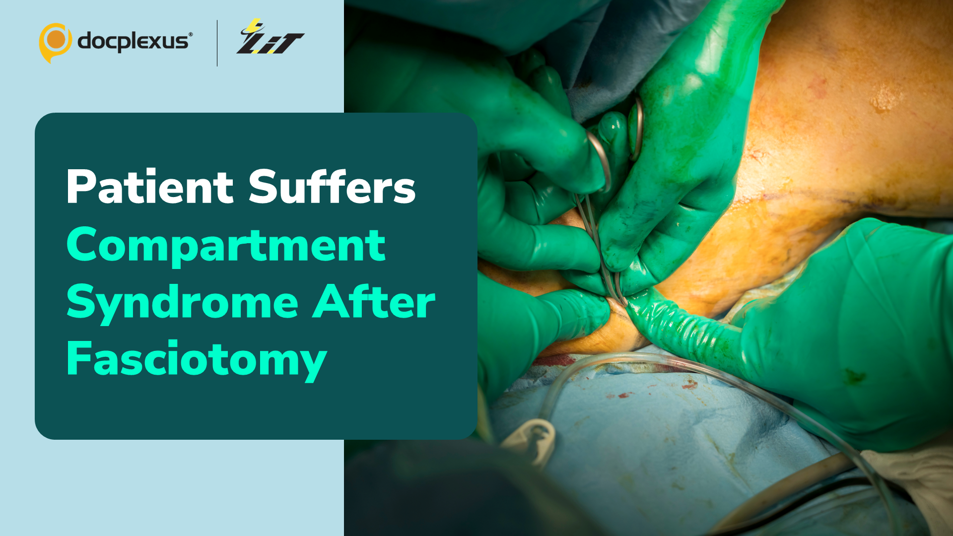 Medical Negligence: Patient Suffers Compartment Syndrome After Fasciotomy