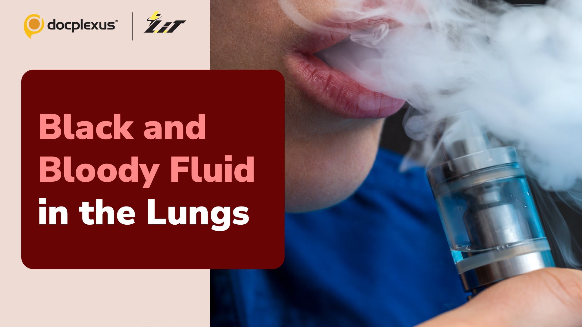 Doctors Remove Two Liters of Black Fluid from Vaper’s Lungs