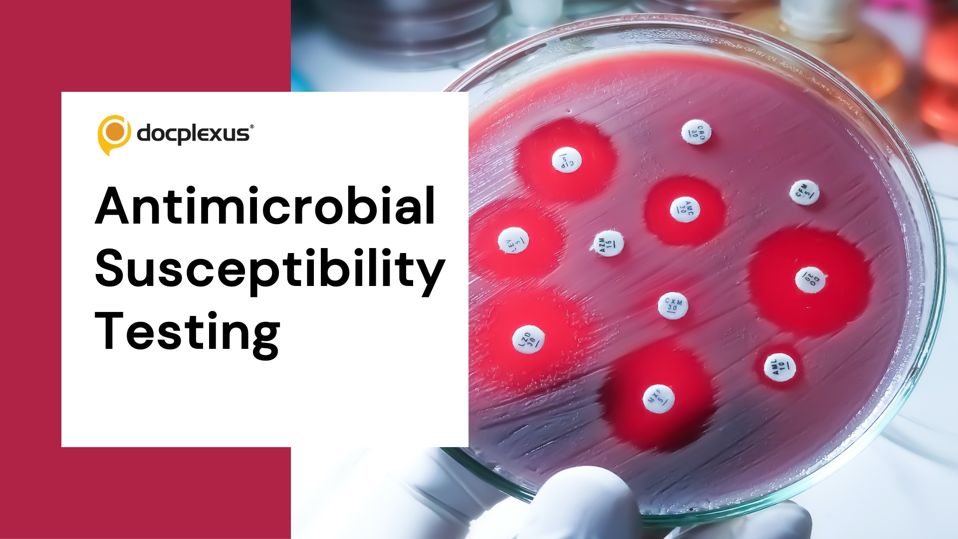 Antimicrobial Susceptibility Testing