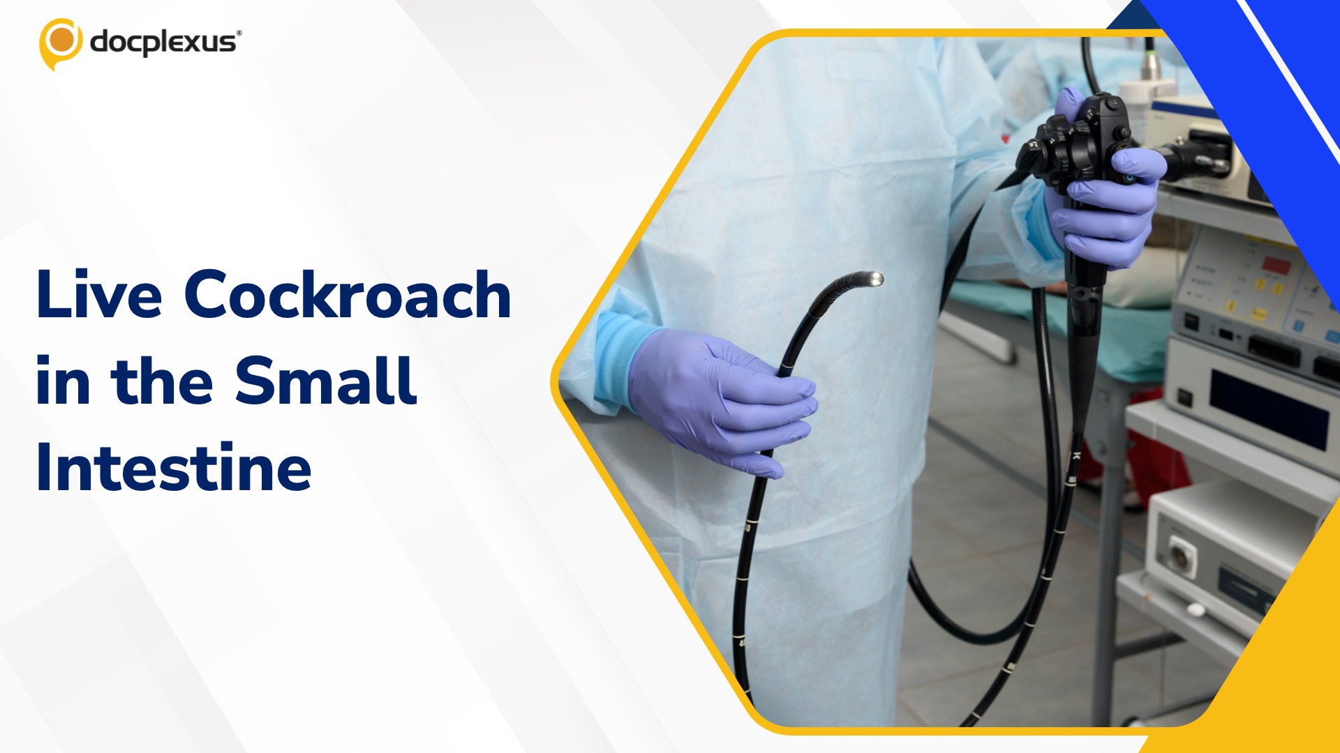 Doctor Removes Cockroach from Man’s GI Tract