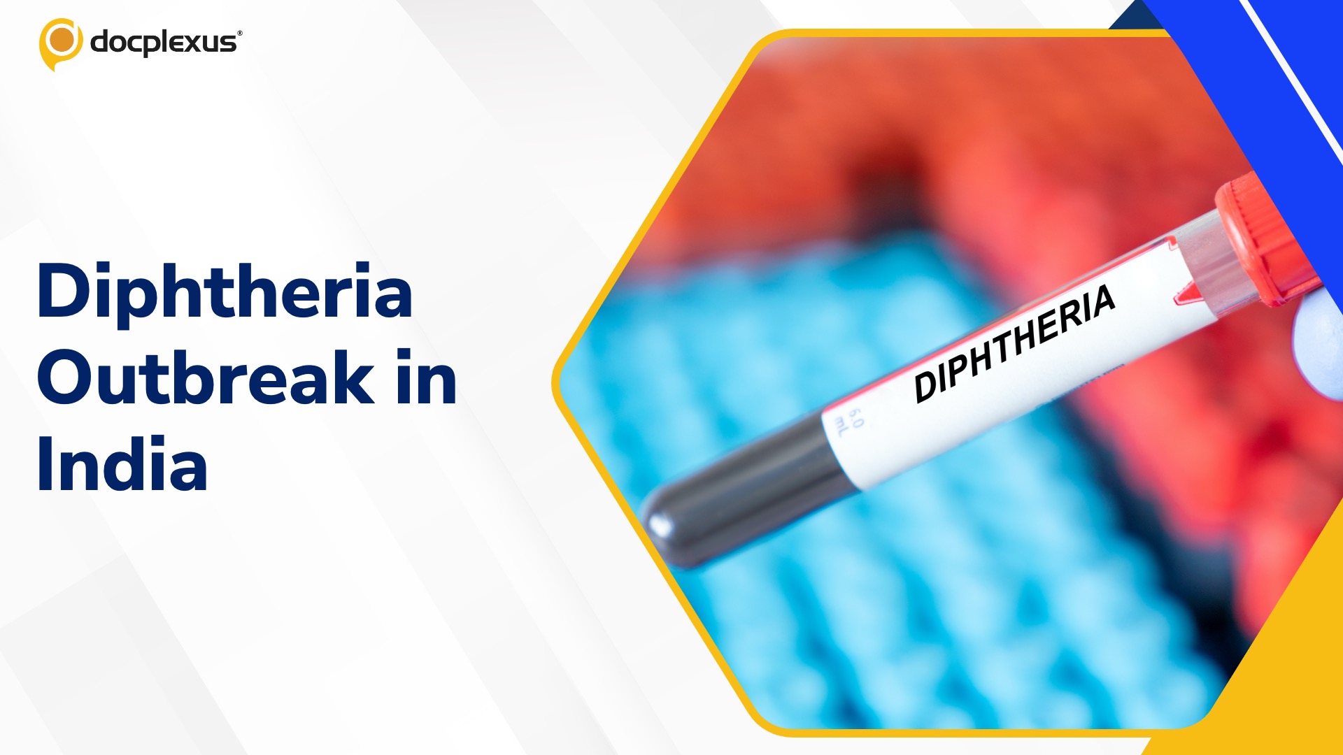 Diphtheria Outbreak Claims Six Lives in Rajasthan