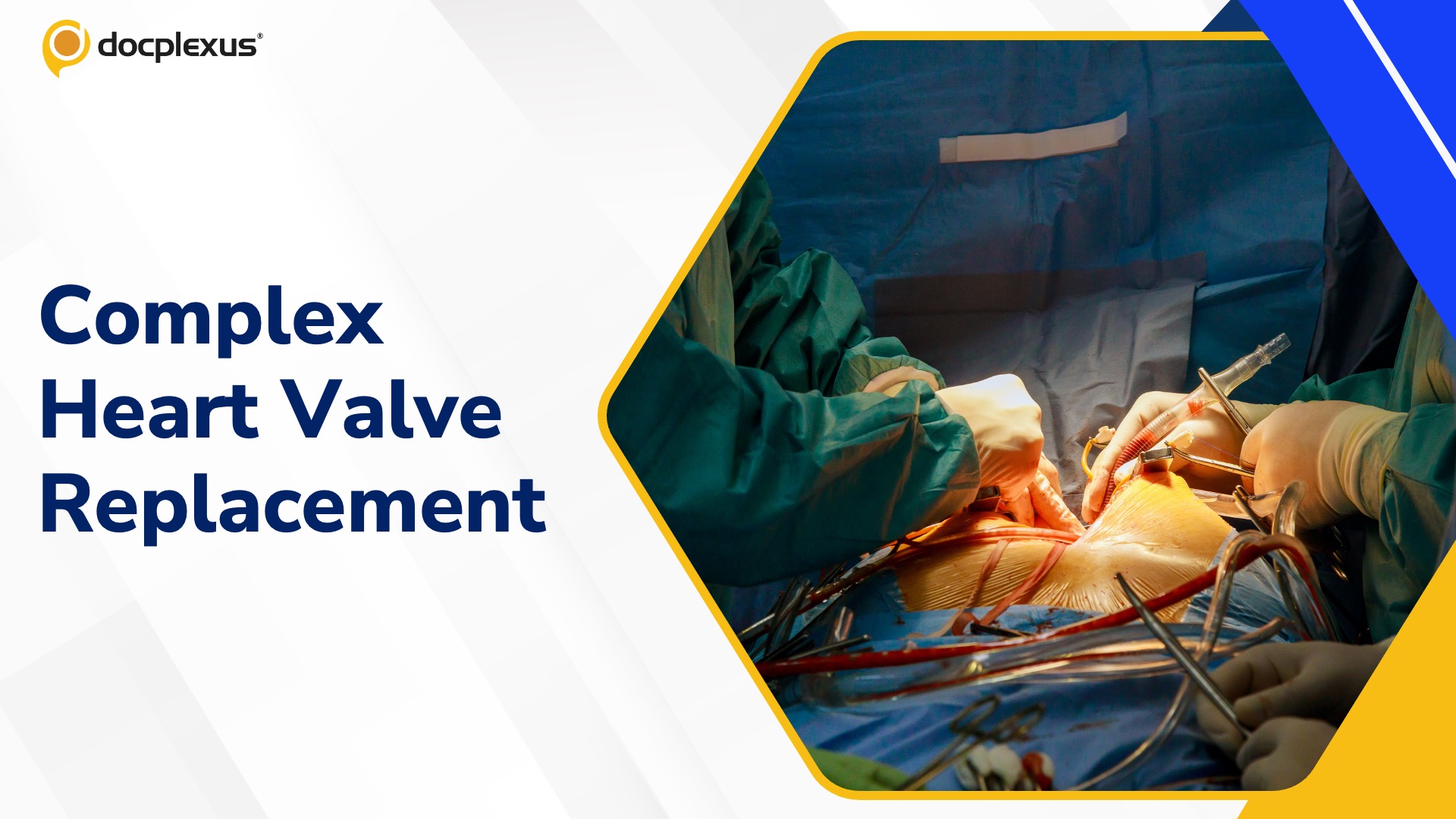 Complex Tricuspid Valve Surgery Saves 60-year-old Patient