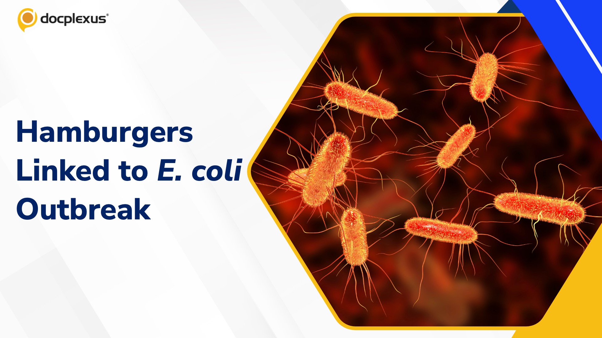 CDC Links E. coli Outbreak to Contaminated Hamburgers