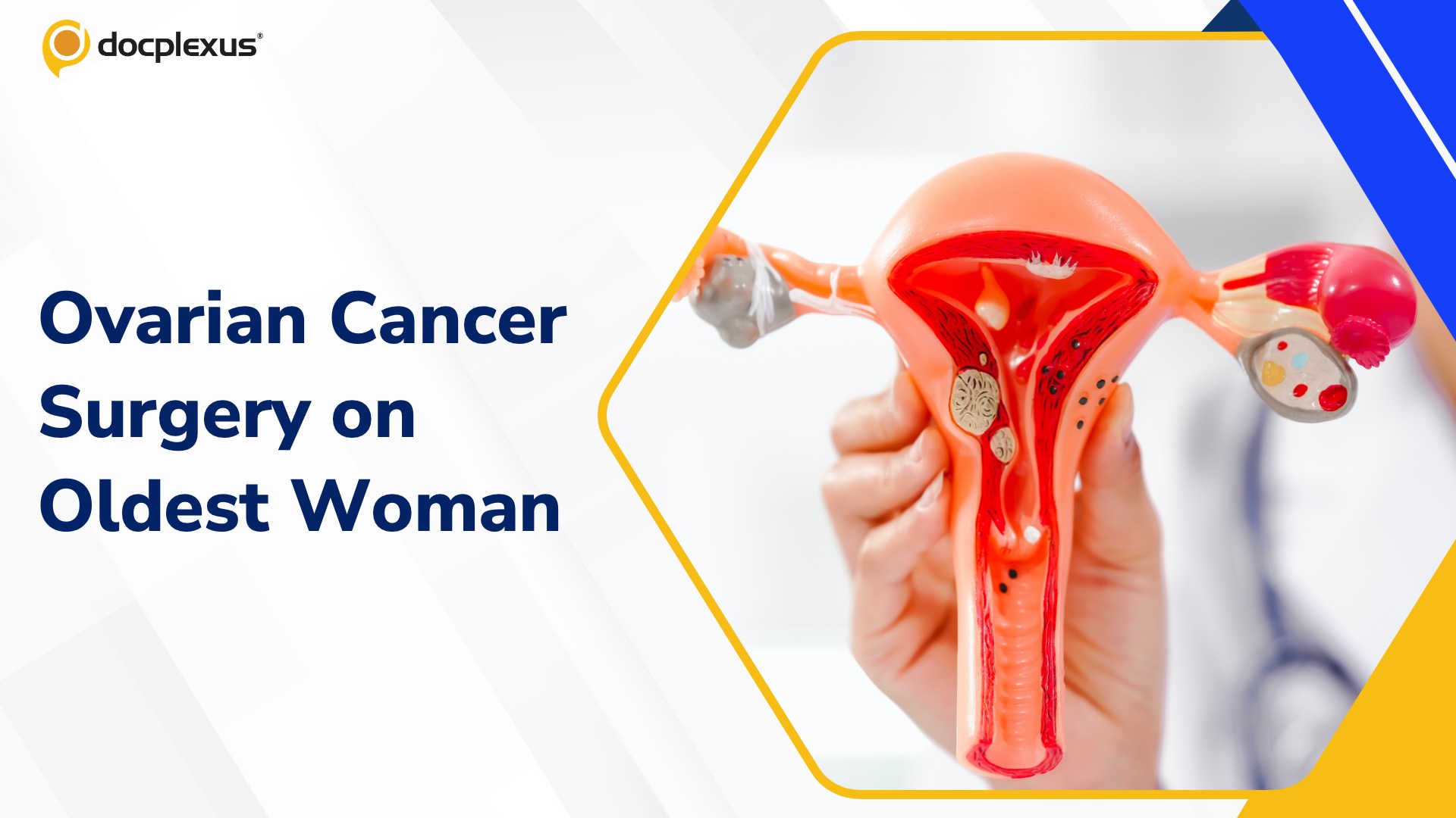 Surgeons Perform Ovarian Cancer Surgery on an 85-year-old Patient