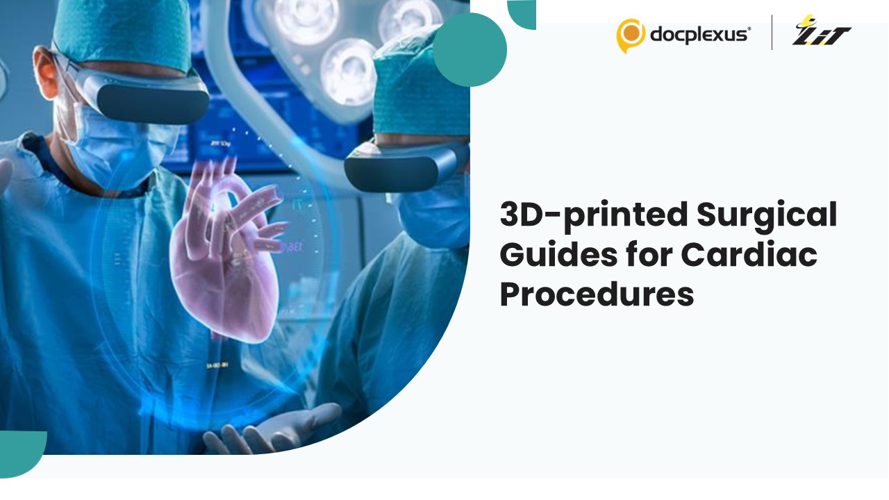 Revolutionizing Heart Surgery: 3D-printed Surgical Guides for Precision and Efficiency