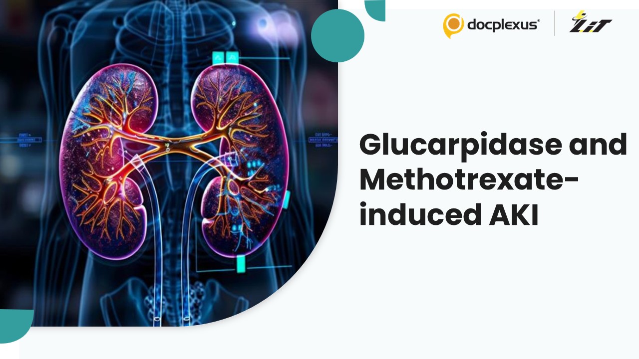 Glucarpidase Offers Hope for Combating Methotrexate-induced Kidney Toxicity