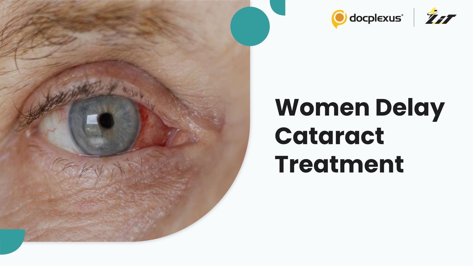 Gender Disparities in Cataract Treatment
