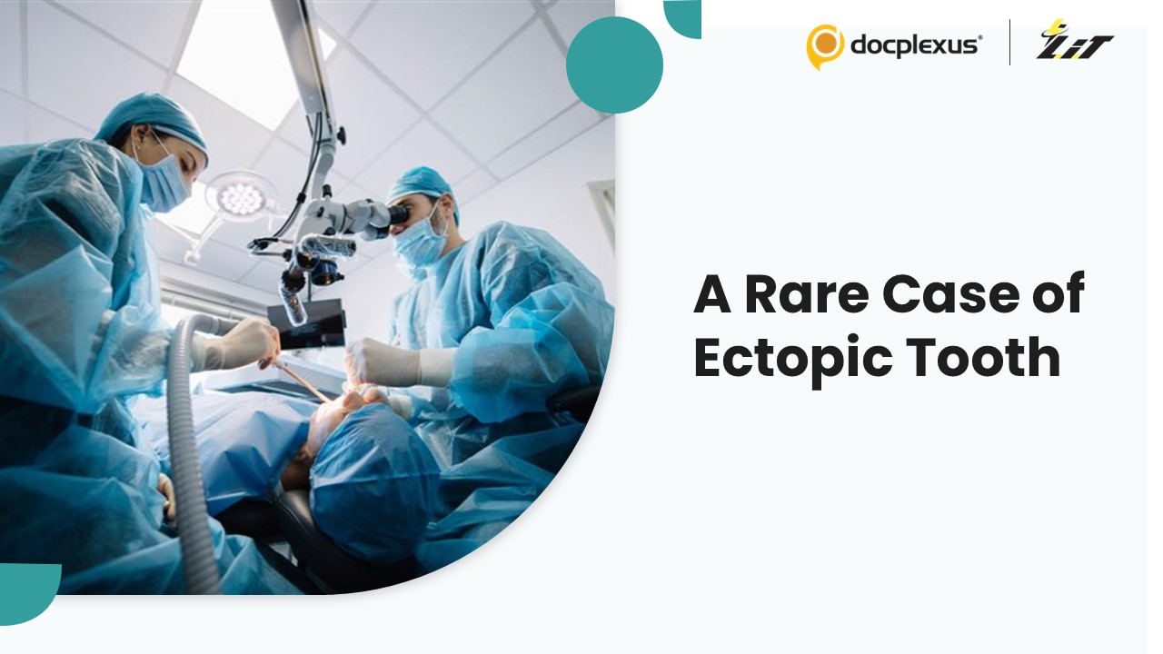 ENT Specialist Removes Ectopic Tooth from Woman’s Nasal Cavity