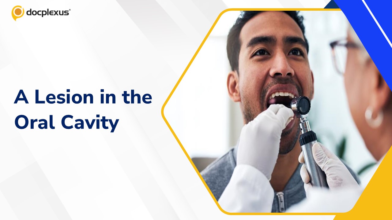 Diagnose This Patient with Rare Lesion in the Oral Cavity
