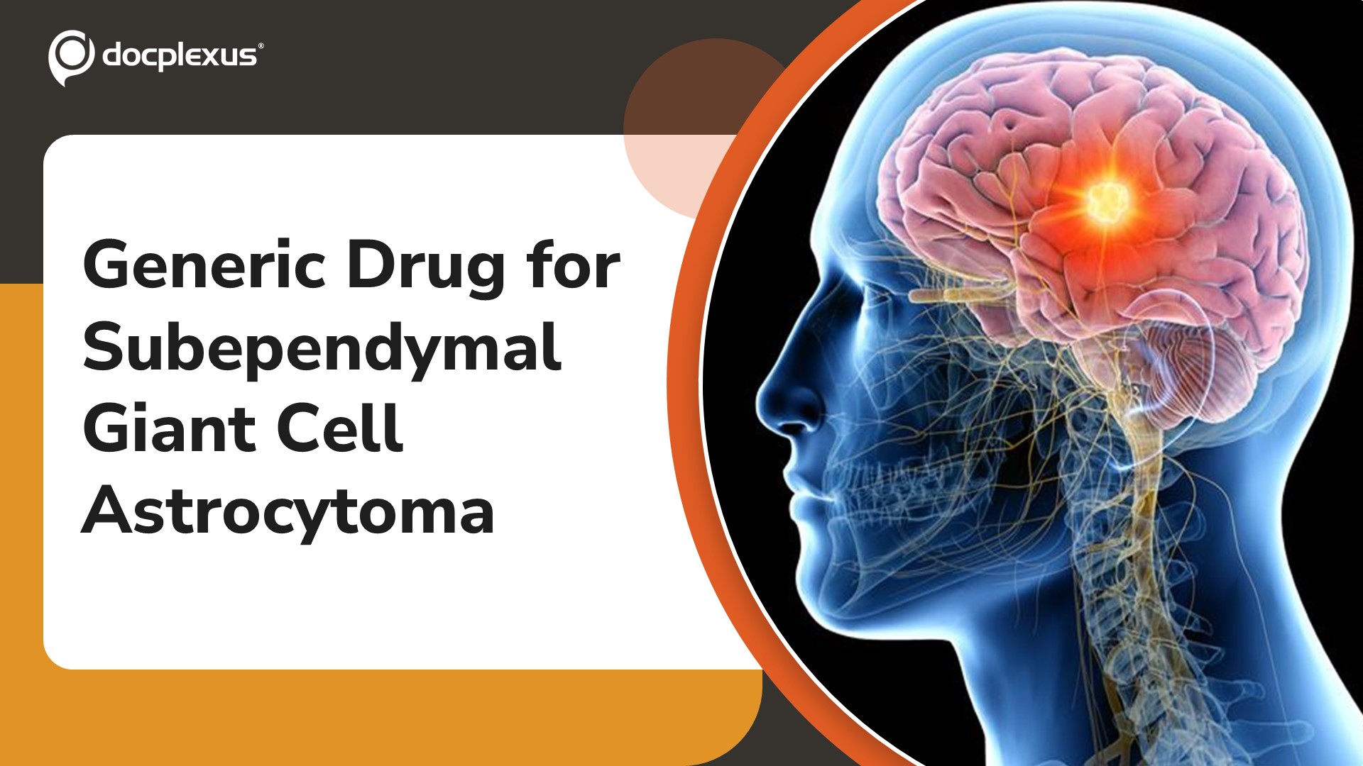 USFDA Approves Generic Everolimus for Subependymal Giant Cell Astrocytoma